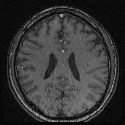 Click on the Serie image to view the images of VILLANUEVA, WILLIAM A.